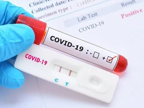 TP. HCM tăng cường kiểm tra các loại test kit xét nghiệm nhanh và xét nghiệm RT-PRC