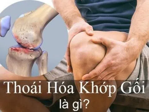 Tại sao người bị thoái hóa khớp gối nên sử dụng Hoàng Thấp Linh