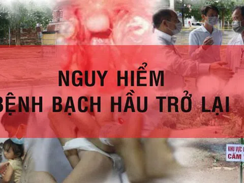 Lý do nào khiến bệnh bạch hầu trở nên nguy hiểm?