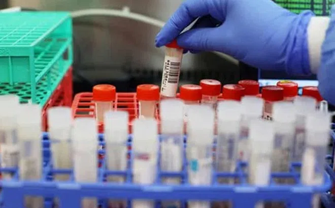 Việt Nam ghi nhận biến thể virus SARS-CoV-2 thứ 5: Chuyên gia nói gì về mức độ nguy hiểm?