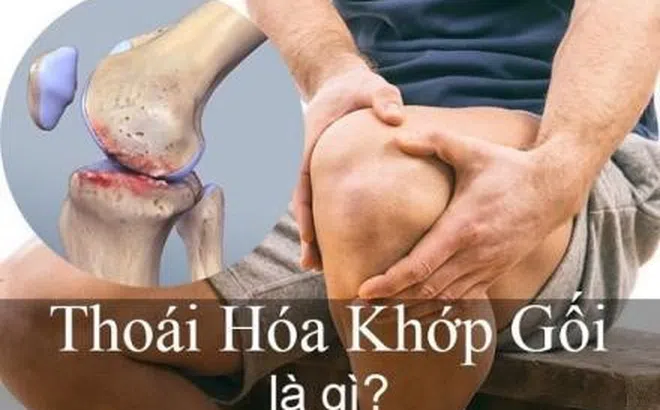 Tại sao người bị thoái hóa khớp gối nên sử dụng Hoàng Thấp Linh